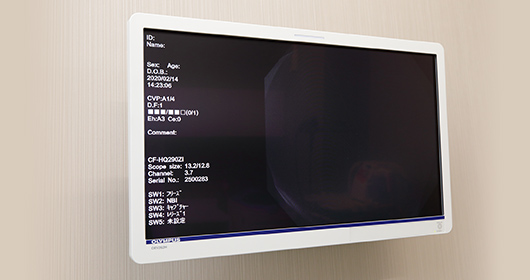 微細な病変も発見できる高精細なハイビジョンモニター